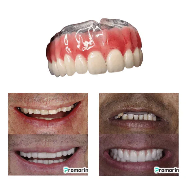 Dentadura de Silicone FIX | Ajustavel e Adaptativa